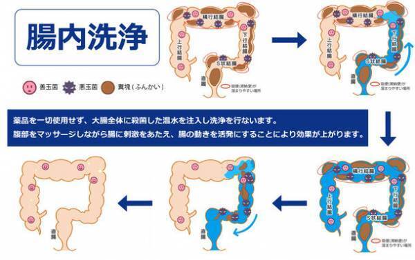 ＜コロナ禍から2年以上経過した現在の健康状態の調査＞ ～全国の働く男女1,000名対象～ 便秘解消には“農作業”が効果的！？全身運動と〇〇を整えて腸を活性化！