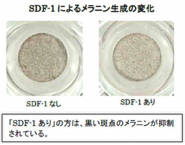 ヤグルマギクにシミ抑制に関わる真皮の「SDF-1」を増やす効果を発見　第75回日本酸化ストレス学会学術集会にて発表