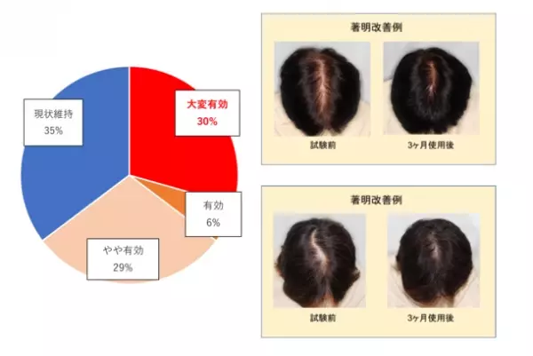 富士産業、週に1回 頭皮の冷却刺激により育毛効果が向上する、新たな育毛アプローチを発見　～ヒトへの有効性の研究成果を報告(第47回 日本香粧品学会)～