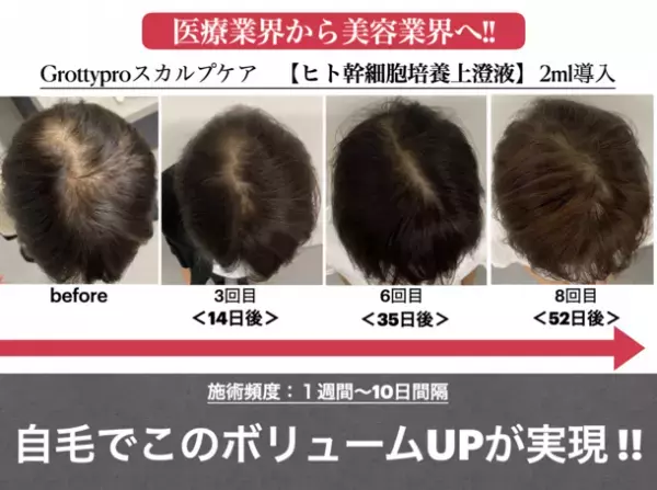 神戸元町発・リラクゼーションサロン「SANPO」が開店記念キャンペーン第2弾を6月17日より開催　初回料金最大15,000円キャッシュバック！