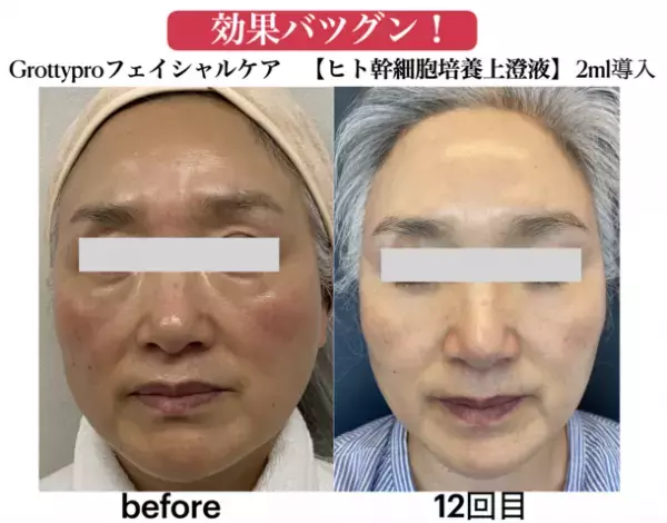 神戸元町発・リラクゼーションサロン「SANPO」が開店記念キャンペーン第2弾を6月17日より開催　初回料金最大15,000円キャッシュバック！