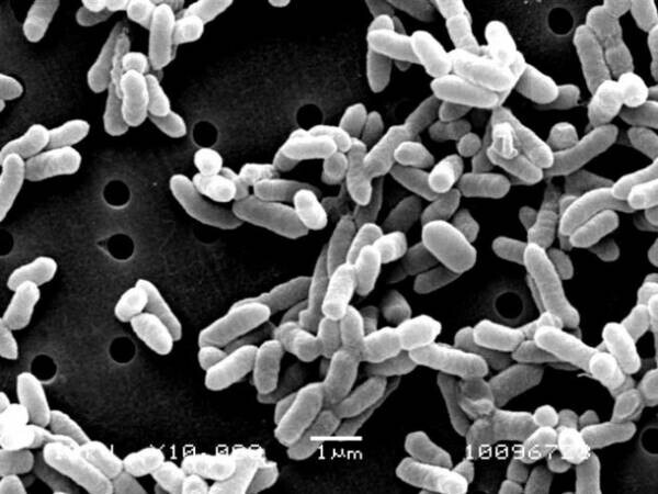 自然免疫応用技研「パントエア菌リポポリサッカライド(LPS)」が米国のダイエタリーサプリメント原料「NDI」として承認を得る