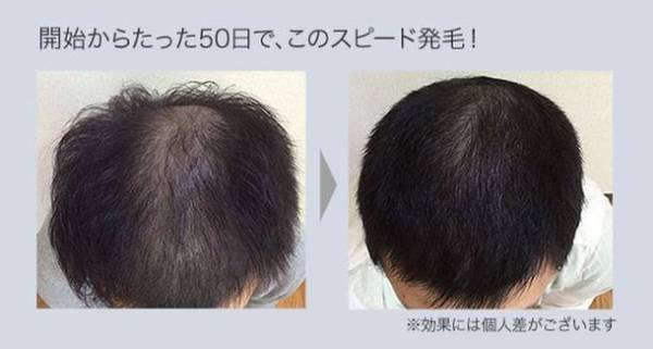 「PATORA高槻店」「BIDAN高槻店」が9月20日で移転後4周年を迎えます！