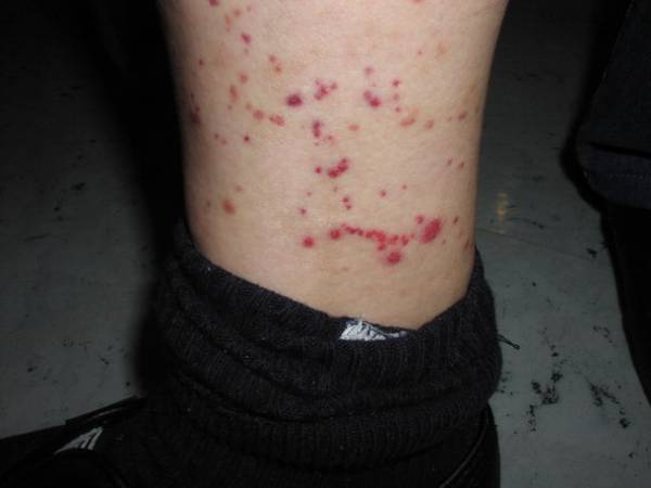 トコジラミ探知犬「ララ」デビュー！鋭い嗅覚を活かして害虫を発見する探知犬が活躍中！