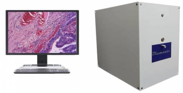 マトリクス、青森産業技術センター工業総合研究所と共同で全自動顕微鏡Diamanteの開発に成功　受注を開始