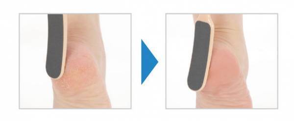 冬のカサカサ＆ひび割れカカトに！ハード＆ソフト面が1本になった“お風呂で使うカカトのやすり”　Amazon限定ブランド「Beakers」より12/26発売