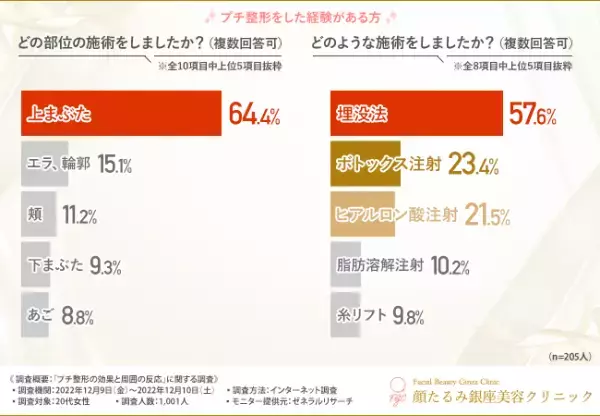 【20代女性のプチ整形経験者は約2割！】経験者の9割以上は施術をして良かったと回答