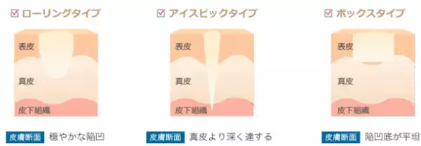 “ニキビ跡の最後の砦に”花房式ニキビ跡治療を提供する『はなふさ皮膚科 京都院』が2月1日にOPEN