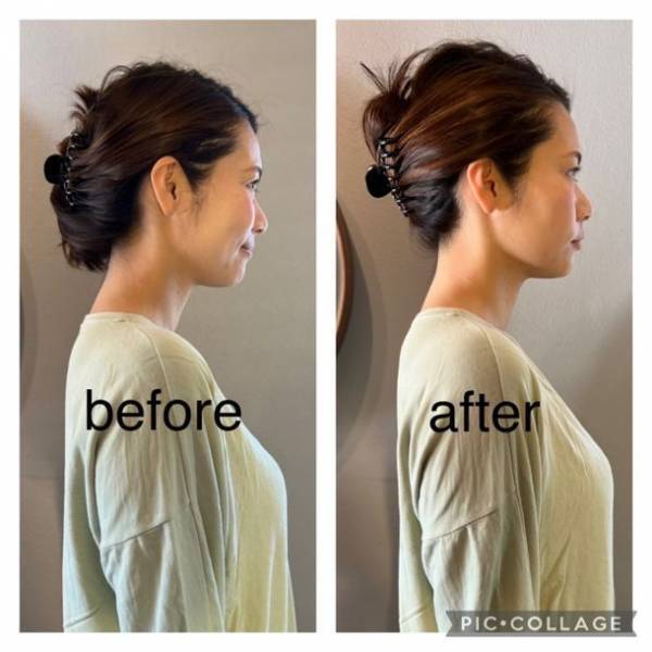 プロポーションが気になる方向け！東京都渋谷区「RACINE」が新サービス『首やせ整体』を2月24日より提供開始　～整形級の首スッキリ・肩スッキリ美人に～