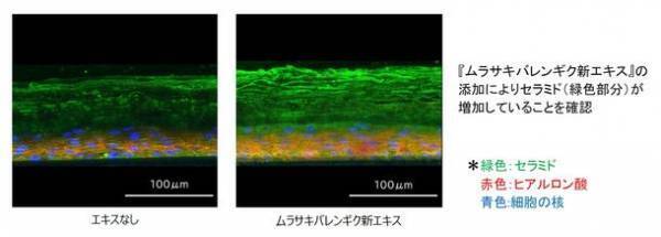 肌のバリア機能に有効な『ムラサキバレンギク新エキス』を開発　日本農芸化学会2023年度大会にて発表