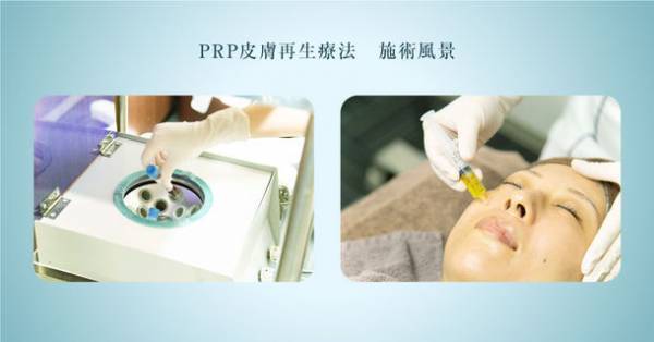 従来の「PRP皮膚再生療法」よりもさらに血小板の濃縮度を高めた「超高級スーパー濃縮PRPプラチナ」が提供開始　2つのプランをお試しいただきやすい価格に改定