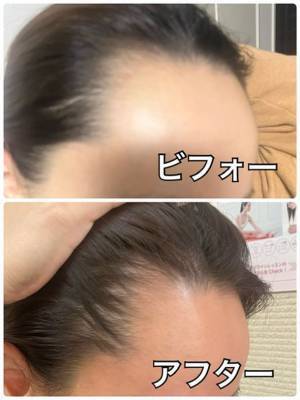 全く新しいコンセプトの女性専用増毛サロン「HGCラボ 新宿店」が4月21日オープン！