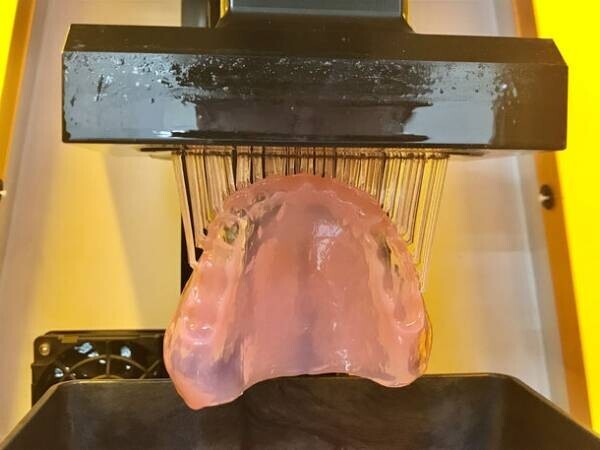 3Dプリンターで製作する予備の義歯『ヨビーバ』が4月から全国で販売開始、最短で即日納品も可能