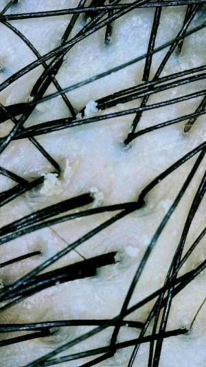 極上の育毛ヘッドスパ“整頭術(せいとうじゅつ)”専門店池袋　有名人ご来店！2023・4地上波放送