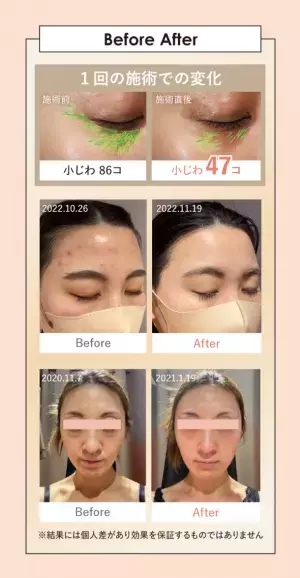 BODY ARCHI(ボディアーキ)から定額制セルフエステの新プラン誕生　エイジング対策×腸内環境でトラブル知らず！