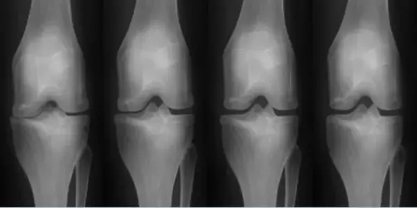 世界幹細胞技術No.1会社EHL BIO、日本に上陸