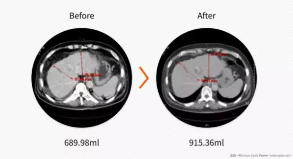 世界幹細胞技術No.1会社EHL BIO、日本に上陸