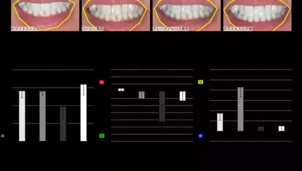 ホワイトニング前後の比較に特化した自撮りアプリを作成、スマホで手軽に効果を確認