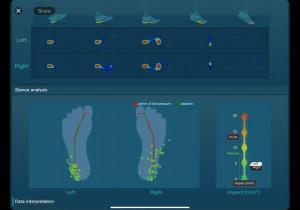 AI歩行分析システムSenno Gait(R)が、自立支援につながる取り組みとしてSOMPOケア株式会社で試験的に導入されました。