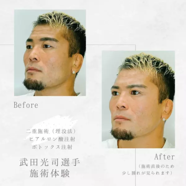 共立美容外科が“総合格闘家 武田光司選手”とスポンサー契約を締結