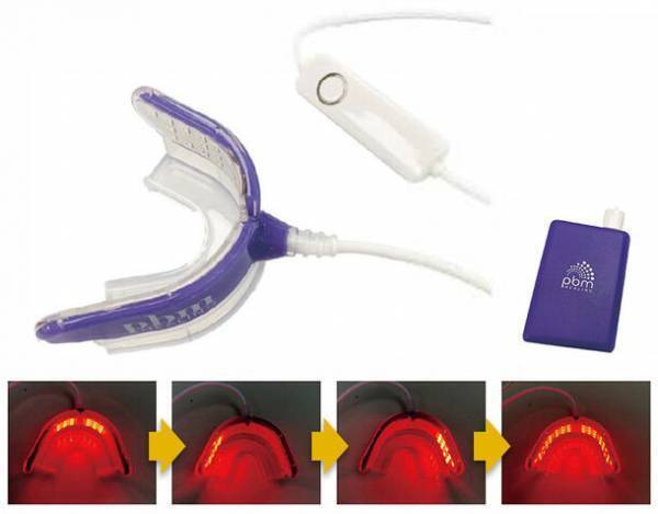 インプラント治療を早く終わらせる「光加速インプラントスピードヒーリング」治療を2023年9月に開始