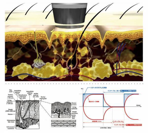 ユニッシュ、脂肪分解注射の代替法に基づくエレクトロポレーション用導入液剤の開発で国内特許を取得！