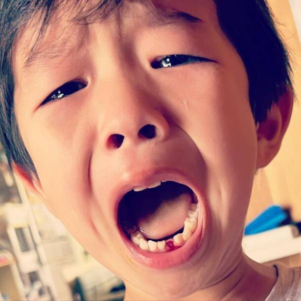 11月8日(いい歯の日)に「歯の生え始め・生え変わりフォトコンテスト」入賞作品発表！