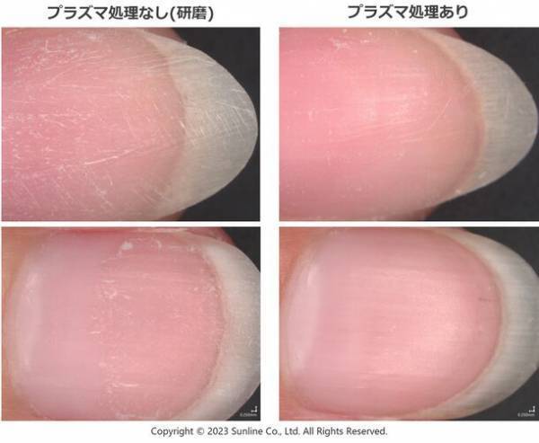 釣り糸のサンライン、美容業界へ初進出　若手開発員のアイデアから大気圧低温プラズマで課題解決