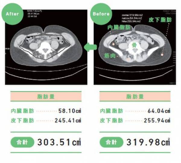 MCTオイル愛用者の名医直伝　書籍「勝手に内臓脂肪が落ちていく食事術」が発売　～正月太り対策の決定版！？～