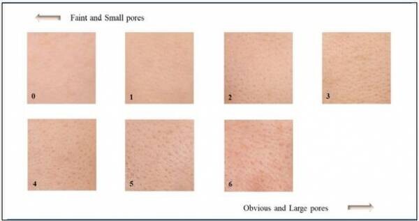 効果実感に期待高まる！毛穴、くすみ、ハリ不足、乾燥、ゴワつき改善へ　高濃度ビタミンC誘導体とノイバラ果実エキスの併用によるヒトの肌への効果を検証