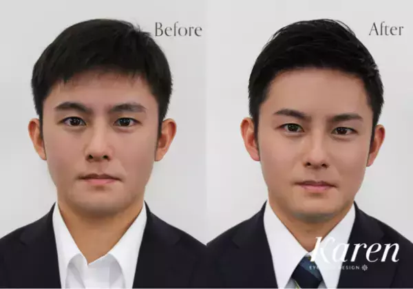 20代から50代までの成人男性963名に緊急調査を実施！3大悩みは「眉が濃い又は薄い」「左右対称にならない」「似合う形がわからない」との結果に！