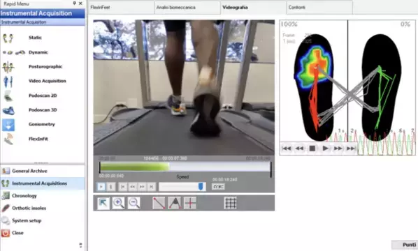 「自分の足に合う靴がない！」世界のフィギュアスケート選手の靴が合わない悩みも解決できる「足のパフォーマンス測定」を一般向けにサービス開始