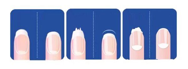 プロジェクト開始2時間で目標達成！まるでお風呂上りのように柔らかく切れる新感覚爪切りシルキークリッパーがプロジェクト実施中！～現在500％達成中～