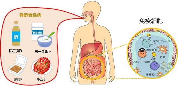 【食生活も影響か】Z世代以下の花粉症デビューは、平均11.58歳　発酵食品「にごり酢」に含まれる酢酸菌が、鼻づまり症状緩和の新たな選択肢に