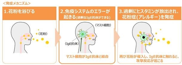 【食生活も影響か】Z世代以下の花粉症デビューは、平均11.58歳　発酵食品「にごり酢」に含まれる酢酸菌が、鼻づまり症状緩和の新たな選択肢に