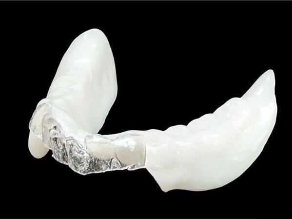 寝ながら予防？今やメジャーな死因の誤嚥性肺炎　入れ歯を30分預けて7日で完成、夜専用入れ歯に部分入れ歯登場