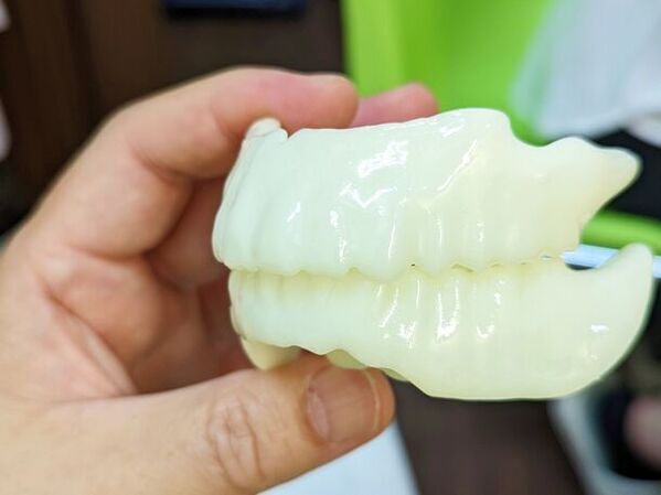 寝ながら予防？今やメジャーな死因の誤嚥性肺炎　入れ歯を30分預けて7日で完成、夜専用入れ歯に部分入れ歯登場