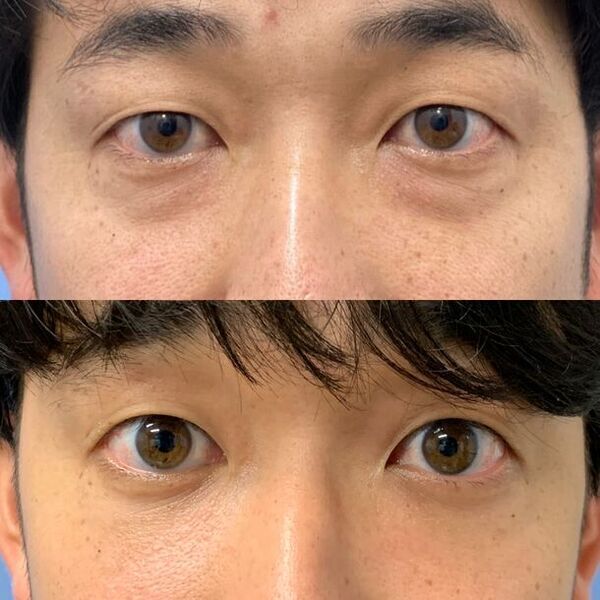 大阪市心斎橋の木田ビューティークリニックが3月1日から開院1周年キャンペーンを開催