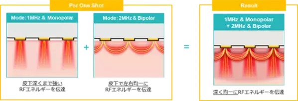 ダーマペンの超進化版！最先端美肌マシン「ポテンツァ」を8月より立川院へ導入開始　特別価格19,800円税込～でご提供