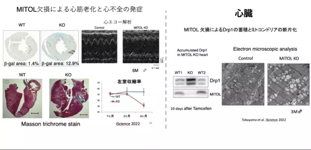 “若返りの鍵”ミトコンドリアを活性化する魔法の成分「マイトルビン」を活用した美容健康サプリの開発を加速　クラファン達成率2,800％超！期待の最新研究