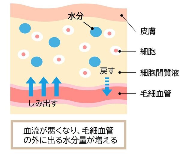 実はそれ、冬太りではなくカラダの「むくみ」かも　カラダの「めぐり」不足による冬の体重増加には要注意！　石原新菜先生へのインタビュー記事を公開　