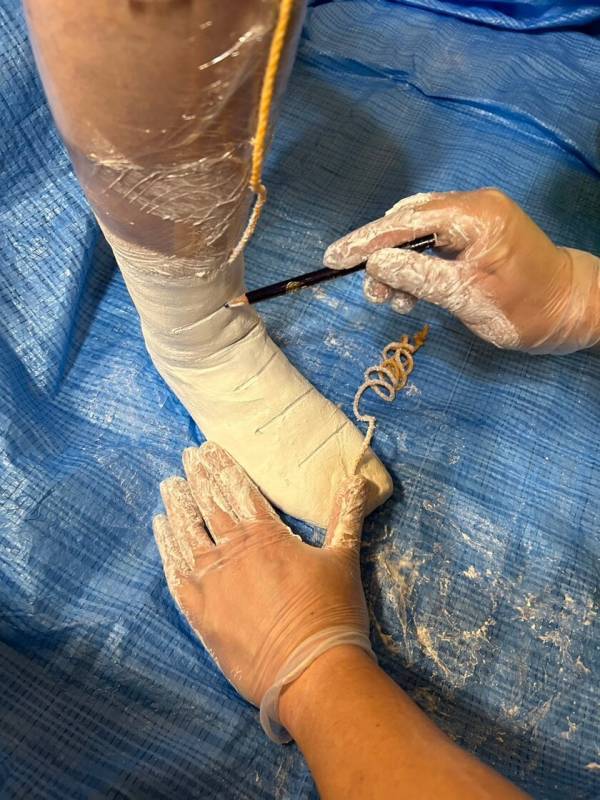 子どもの「したい」「なりたい」を増やすオーダーメイドリハビリ　株式会社アローが小児向け自費リハビリ事業を1月20日に開始