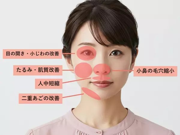 美容皮膚科まゆりなclinic名古屋栄でオリジオ最新機種の『オリジオKISS』を導入
