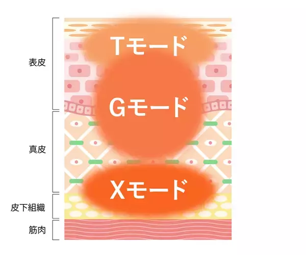 美容皮膚科まゆりなclinic名古屋栄でオリジオ最新機種の『オリジオKISS』を導入