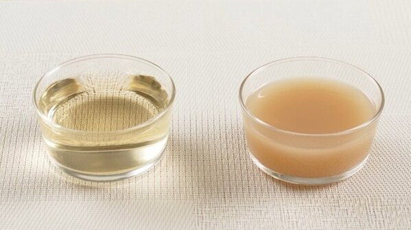 【花粉症症状は通年化の時代へ】花粉症持ちの約8割が、症状の長期化を実感　江戸時代ごろの「にごり酢」に含まれる「酢酸菌」が、鼻づまり症状緩和の新常識に