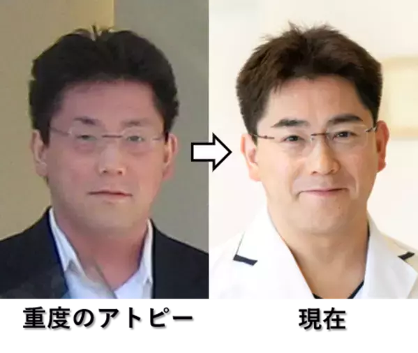 骨粗鬆症の書籍で伝えられなかった「適切な食事」について、3月21日のサイトリニューアルで追加発信