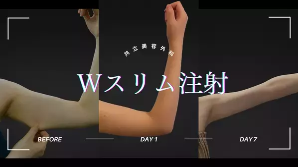 【共立美容外科】新メニュー「Wスリム注射」導入　最新の切らない痩身施術　脂肪吸引より手軽、脂肪溶解注射より着実