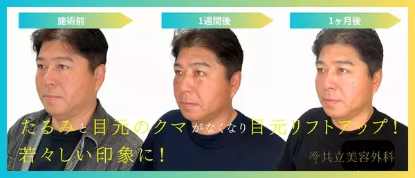 元東京ヤクルトスワローズ監督・真中満氏が共立美容外科で実感！自然なクマ取りで若々しい印象へ