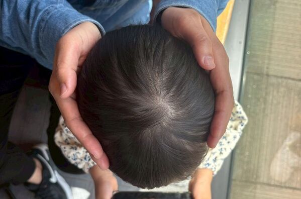 赤ちゃんの頭をまん丸に！AGOセラピストスクールが100名限定で頭の形ケアモニターを募集　沖縄県那覇市で7月22日に開催