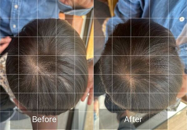 赤ちゃんの頭をまん丸に！AGOセラピストスクールが100名限定で頭の形ケアモニターを募集　沖縄県那覇市で7月22日に開催